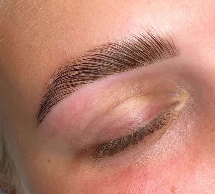 en kunds bryn med en nyligen behandlad browlift